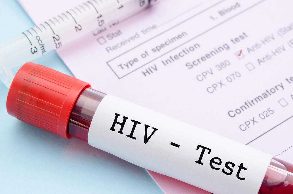 miten välittää HIV