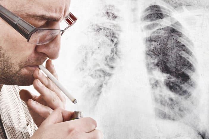 keuhkosyövän oireet