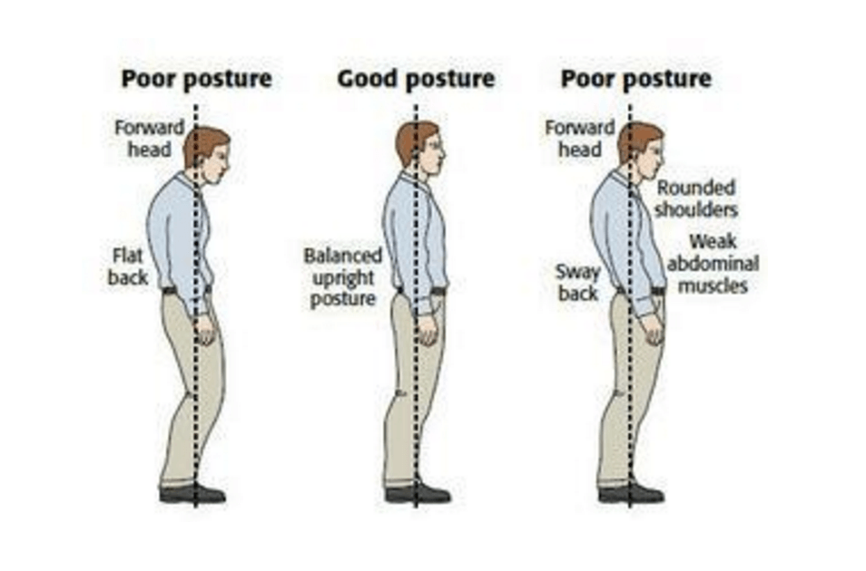 Kuvan lähde: http://www.thephysiocompany.com/blog/stop-slouching-postural-dysfunction-symptoms-causes-and-treatment-of-bad-posture