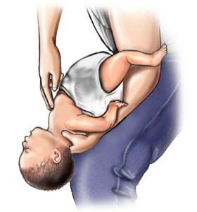 Vaiheet, joilla autetaan tukehtumaan vauvoja (4-5): www.webmd.com