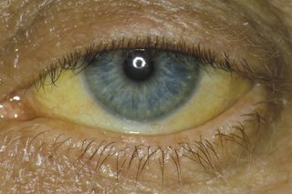 keltaiset silmät