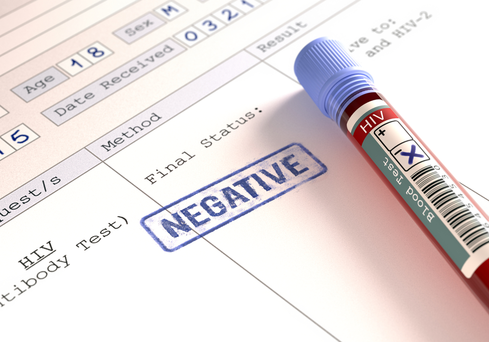 negatiivisen HIV-testin tulosten merkitys